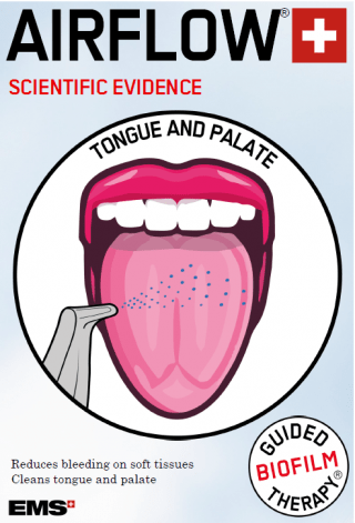 superficie de la lengua y paladar