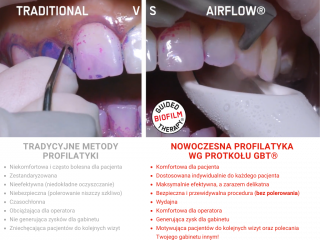 PL - GBT vs old methods comparison