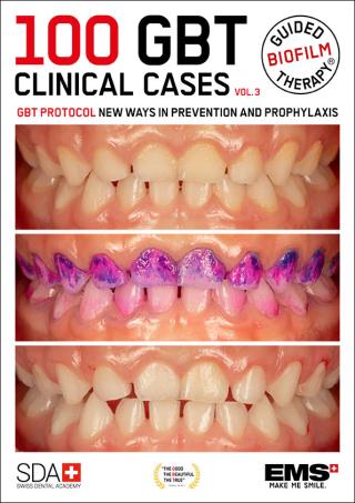 100 GBT clinical cases