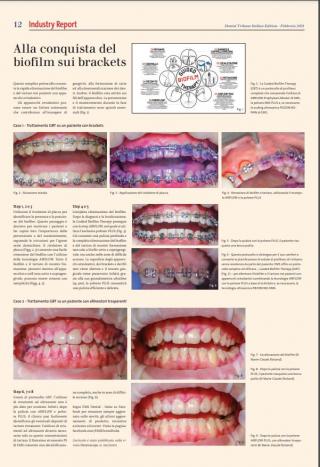 2021_02_Dental Tribune